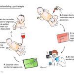 Meer tijd voor gentherapie bij ernstige afweerstoornis bij baby’s