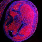 Leidse biologen vinden nanoplastics in ontwikkelend hart