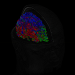 Depressie onder de scan