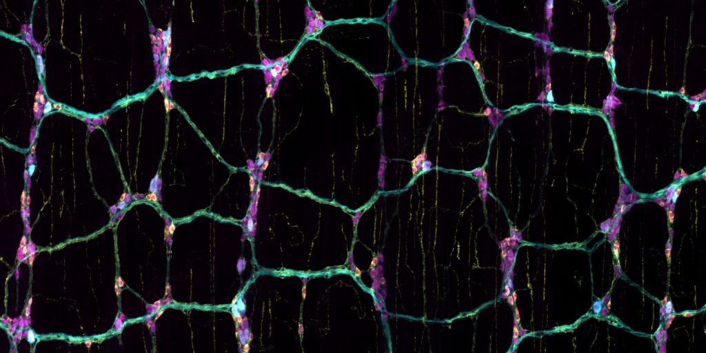 Microscopisch beeld van zenuwcellen in de buik