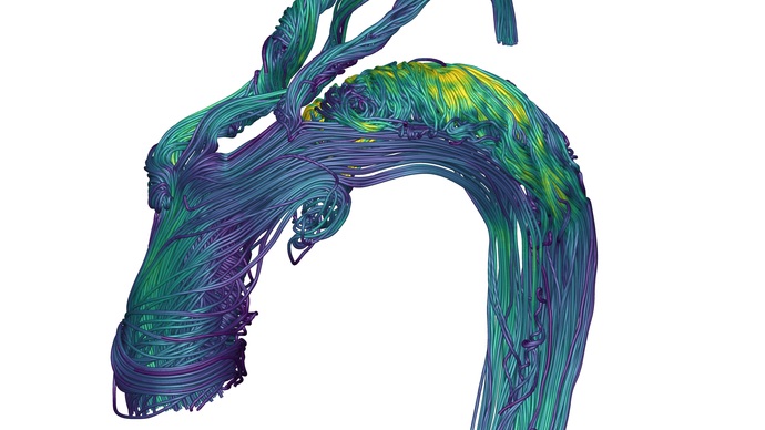 Digital twin aorta