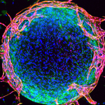 Mini-organen op een chip steeds geavanceerder