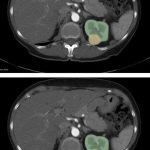 Superkrachtige AI uit Eindhoven helpt artsen kanker en andere ziektes sneller te ontdekken