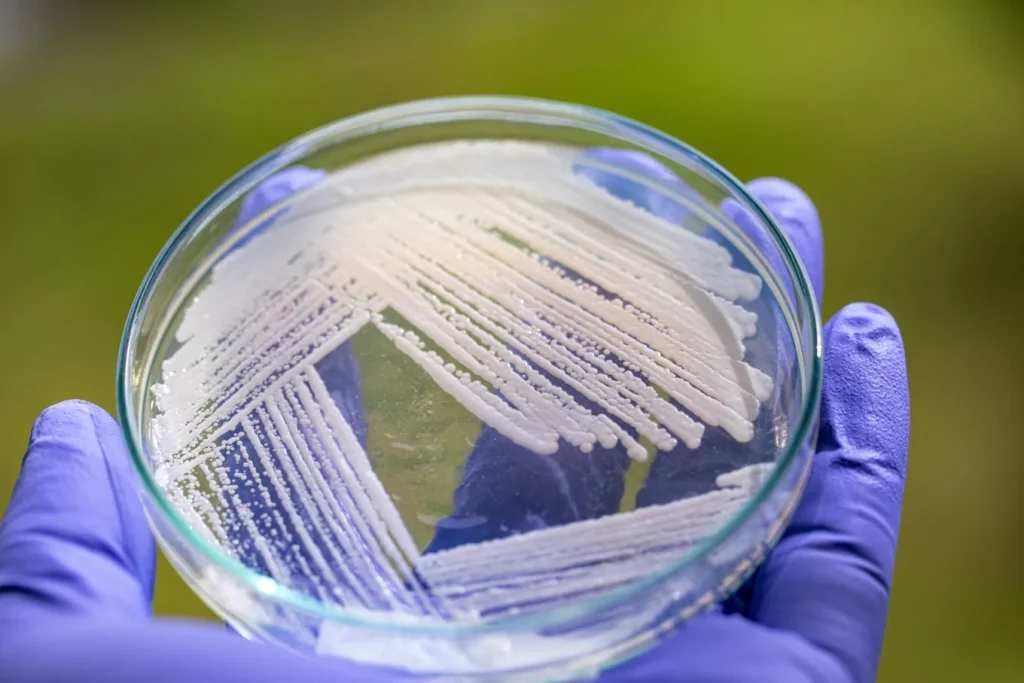 Gist in een petri-schaaltje