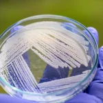 Celdoodmechanismen bij gist